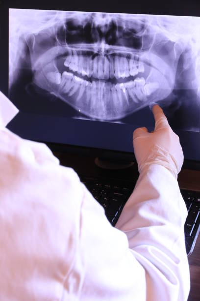 Best Emergency Root Canal Treatment in Winters, CA